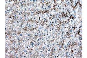 Immunohistochemical staining of paraffin-embedded Human liver tissue using anti-EIF2S1 mouse monoclonal antibody. (EIF2S1 Antikörper)