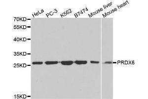 Western blot analysis of extracts of various cell lines, using PRDX6 antibody (ABIN5971063) at 1/1000 dilution. (Peroxiredoxin 6 Antikörper)