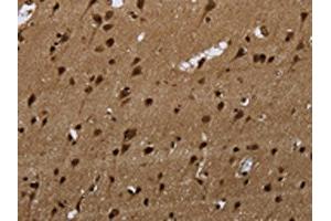 The image on the left is immunohistochemistry of paraffin-embedded Human brain tissue using ABIN7189815(ANP32E Antibody) at dilution 1/20, on the right is treated with synthetic peptide. (ANP32E Antikörper)