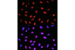 Immunofluorescence analysis of U-2 OS cells using P Rabbit mAb (ABIN7269445) at dilution of 1:100 (40x lens). (PABPN1 Antikörper)
