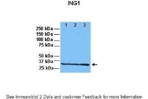 Lanes:   1: 30ug HeLa lysate, 2: 30ug HFF lysate, 3: 30ug U2OS lysate  Primary Antibody Dilution:   1:1000  Secondary Antibody:   Anti-rabbit HRP  Secondary Antibody Dilution:   1:5000  Gene Name:   ING1  Submitted by:   Dr. (ING1 Antikörper  (C-Term))