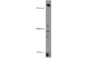 Western Blotting (WB) image for anti-Xin Actin-Binding Repeat Containing 2 (XIRP2) antibody (ABIN2906145) (XIRP2 Antikörper)