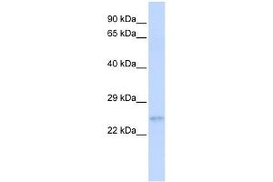 RHOC antibody used at 1 ug/ml to detect target protein. (RHOC Antikörper  (N-Term))
