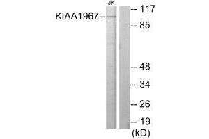 Western blot analysis of extracts from Jurkat cells, using KIAA1967 antibody. (CCAR2 Antikörper)
