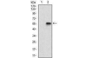 Western blot analysis using GABBR2 mAb against HEK293 (1) and GABBR2 (AA: 319-483)-hIgGFc transfected HEK293 (2) cell lysate. (GABBR2 Antikörper  (AA 319-483))