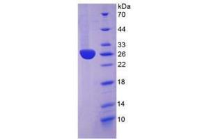 SDS-PAGE analysis of Rabbit C-Reactive Protein. (CRP Protein)
