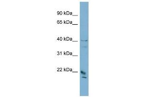 DYDC1 antibody used at 1 ug/ml to detect target protein. (DYDC1 Antikörper  (Middle Region))