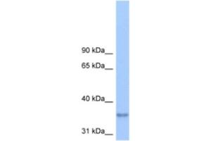 Western Blotting (WB) image for anti-Lipid Phosphate Phosphatase-Related Protein Type 2 (LPPR2) antibody (ABIN2463290) (LPPR2 Antikörper)