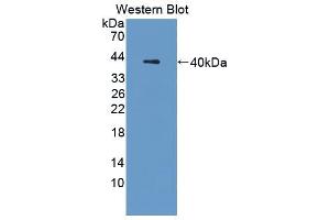 Western blot analysis of the recombinant protein. (Cathepsin L Antikörper  (AA 18-113))