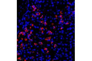 Immunofluorescence of paraffin embedded rat stomach using TR2IT1 (ABIN7075887) at dilution of 1:650 (400x lens) (TXNRD3NB Antikörper)