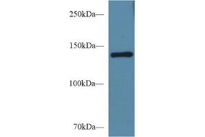 Western blot analysis of Mouse Serum, using Mouse SEMA4D Antibody (1 µg/ml) and HRP-conjugated Goat Anti-Rabbit antibody ( (SEMA4D/CD100 Antikörper  (AA 502-636))
