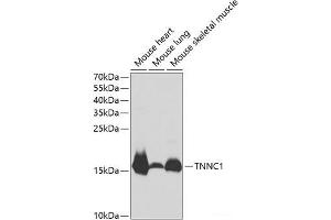 Western blot analysis of extracts of various cell lines using TNNC1 Polyclonal Antibody at dilution of 1:1000. (TNNC1 Antikörper)
