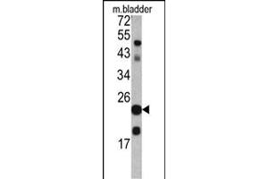 Western blot analysis of TAGLN antibody in mouse bladder tissue lysates (35ug/lane) (Transgelin Antikörper  (C-Term))