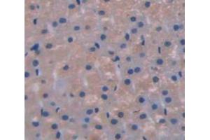 Used in DAB staining on fromalin fixed paraffin- embedded Kidney tissue (GLI1 Antikörper  (AA 810-1109))