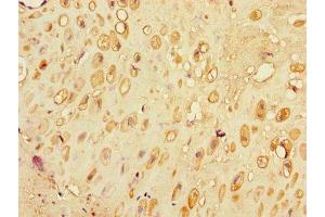 Immunohistochemistry of paraffin-embedded human placenta tissue using ABIN7176684 at dilution of 1:100 (SLC3A7 (AA 162-236) Antikörper)