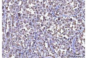 IHC analysis of RNF34 using anti-RNF34 antibody (ABIN7602457). (RNF34 Antikörper  (AA 46-372))