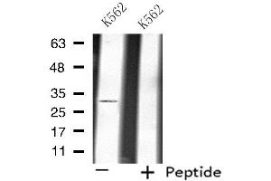 Western blot analysis of extracts from K562 cells, using ATP1B3 antibody. (ATP1B3 Antikörper  (Internal Region))