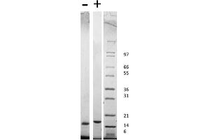 SDS-PAGE of Rat Stem Cell Factor Recombinant Protein SDS-PAGE of Rat Stem Cell Factor Recombinant Protein. (KIT Ligand Protein (KITLG))