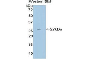 Western Blotting (WB) image for anti-SP100 Nuclear Antigen (SP100) (AA 261-465) antibody (ABIN1860601) (SP100 Antikörper  (AA 261-465))