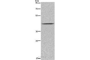 Western blot analysis of Mouse liver tissue, using JMJD6 Polyclonal Antibody at dilution of 1:800 (JMJD6 Antikörper)