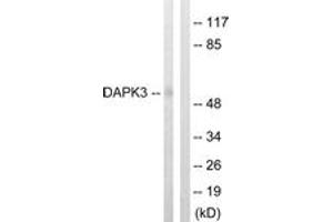 Western blot analysis of extracts from HuvEc cells, using DAPK3 (Ab-265) Antibody. (DAPK3 Antikörper  (AA 241-290))