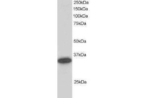 Western Blotting (WB) image for Carbonyl Reductase 1 (CBR1) peptide (ABIN370305) (Carbonyl Reductase 1 (CBR1) Peptid)