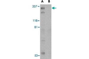 Western blot analysis of TSC2 in L1210 cell lysate with TSC2 polyclonal antibody  at 1 ug/mL in the (A) absence and (B) presence of blocking peptide.