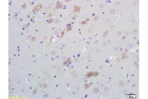 Formalin-fixed and paraffin embedded rat brain tissue labeled with Anti-SCD1 Polyclonal Antibody, Unconjugated (ABIN704111) at 1:200 followed by conjugation to the secondary antibody and DAB staining (SCD Antikörper  (AA 265-359))