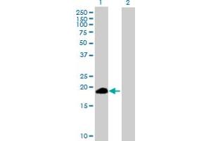 Western Blot analysis of ZSCAN1 expression in transfected 293T cell line by ZSCAN1 MaxPab polyclonal antibody. (ZSCAN1 Antikörper  (AA 1-178))