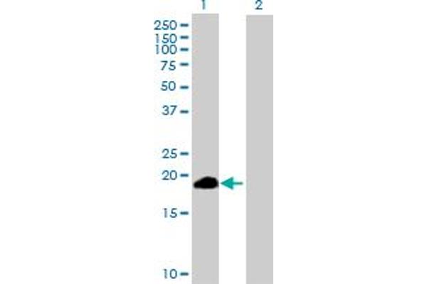 ZSCAN1 Antikörper  (AA 1-178)