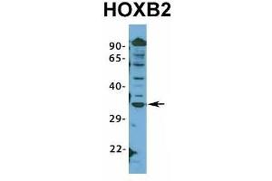 Host:  Rabbit  Target Name:  HOXB2  Sample Type:  HepG2  Antibody Dilution:  1. (HOXB2 Antikörper  (N-Term))