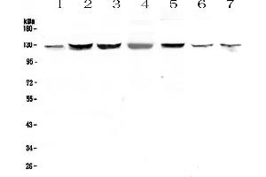 Western blot analysis of SMC6L1 using anti-SMC6L1 antibody . (SMC6 Antikörper  (AA 205-443))