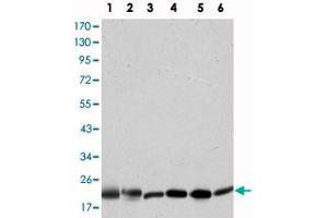 Western blot analysis using BID monoclonal antibody, clone 3C5  against HeLa (1), A-431 (2), Jurkat (3), A-549 (4), HepG2 (5), and HEK293 (6) cell lysate. (BID Antikörper)