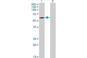 Western Blot analysis of FPGT expression in transfected 293T cell line by FPGT MaxPab polyclonal antibody. (FPGT Antikörper  (AA 1-594))