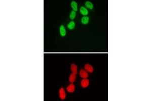 SMARCB1 antibody (mAb) (Clone 2C2) tested by immunofluorescence. (SMARCB1 Antikörper)