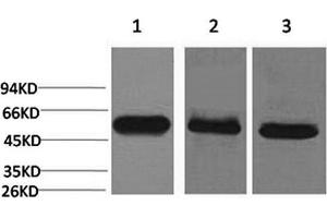 Western Blotting (WB) image for anti-Caspase 8 (CASP8) antibody (ABIN5960798) (Caspase 8 Antikörper)