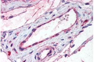 Human Testis, Vessels (formalin-fixed, paraffin-embedded) stained with ADAMTS1 antibody ABIN292613 at 20 ug/ml followed by biotinylated goat anti-rabbit IgG secondary antibody ABIN481713, alkaline phosphatase-streptavidin and chromogen. (ADAMTS1 Antikörper  (Internal Region))