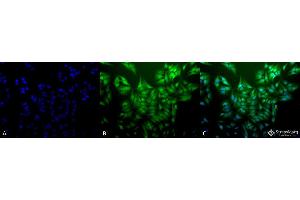 Immunocytochemistry/Immunofluorescence analysis using Mouse Anti-Ubiquitin Monoclonal Antibody, Clone 5B9-B3 . (Ubiquitin Antikörper  (HRP))