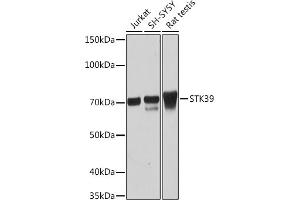 STK39 Antikörper