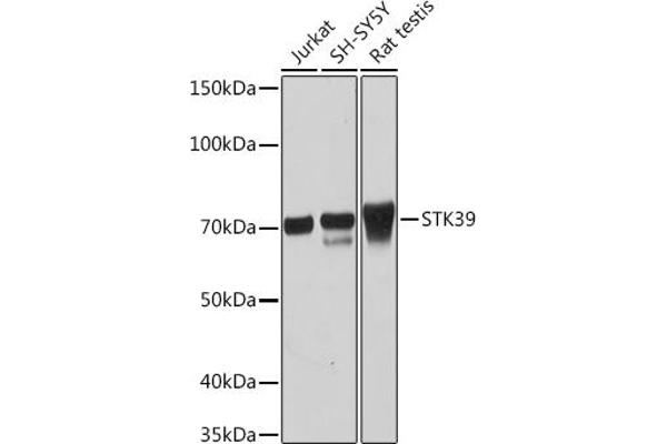 STK39 Antikörper