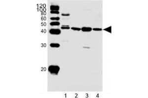 Western blot analysis of lysate from 1) HepG2 cell line and human 2) heart, 3) skeletal muscle, 4) kidney tissue using SPHK1 antibody at 1:1000. (SPHK1 Antikörper  (AA 59-89))