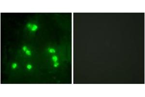 Immunofluorescence analysis of A549 cells, using HAIR Antibody. (Hairless Antikörper  (AA 41-90))