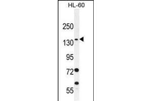 SPECC1 Antibody (Center) (ABIN656081 and ABIN2845427) western blot analysis in HL-60 cell line lysates (35 μg/lane). (NSP5 Antikörper  (AA 705-733))