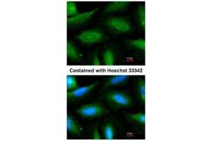 ICC/IF Image Immunofluorescence analysis of methanol-fixed HeLa, using FBXL2, antibody at 1:200 dilution. (FBXL2 Antikörper  (N-Term))