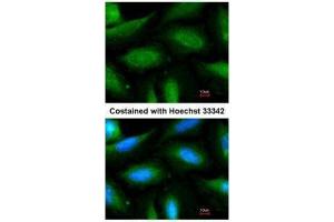 ICC/IF Image Immunofluorescence analysis of methanol-fixed HeLa, using FBXL2, antibody at 1:200 dilution.