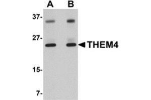 Western blot analysis of THEM4 in human liver tissue lysate with this product at (A) 1 and (B) 2 μg/ml. (THEM4 Antikörper  (Center))