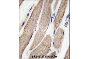 Formalin-fixed and paraffin-embedded human skeletal muscle tissue reacted with MAP2K5 Antibody (S149) , which was peroxidase-conjugated to the secondary antibody, followed by DAB staining. (MAP2K5 Antikörper  (AA 127-156))