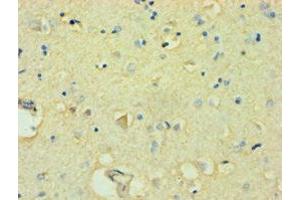 Immunohistochemistry of paraffin-embedded human brain tissue using ABIN7152490 at dilution of 1:100