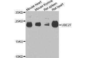 Western blot analysis of extracts of various cell lines, using UBE2T antibody. (Ube2t Antikörper)