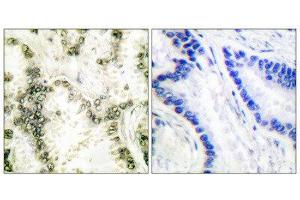Immunohistochemistry (IHC) image for anti-X-Ray Repair Complementing Defective Repair in Chinese Hamster Cells 6 (XRCC6) (C-Term) antibody (ABIN1848653) (XRCC6 Antikörper  (C-Term))